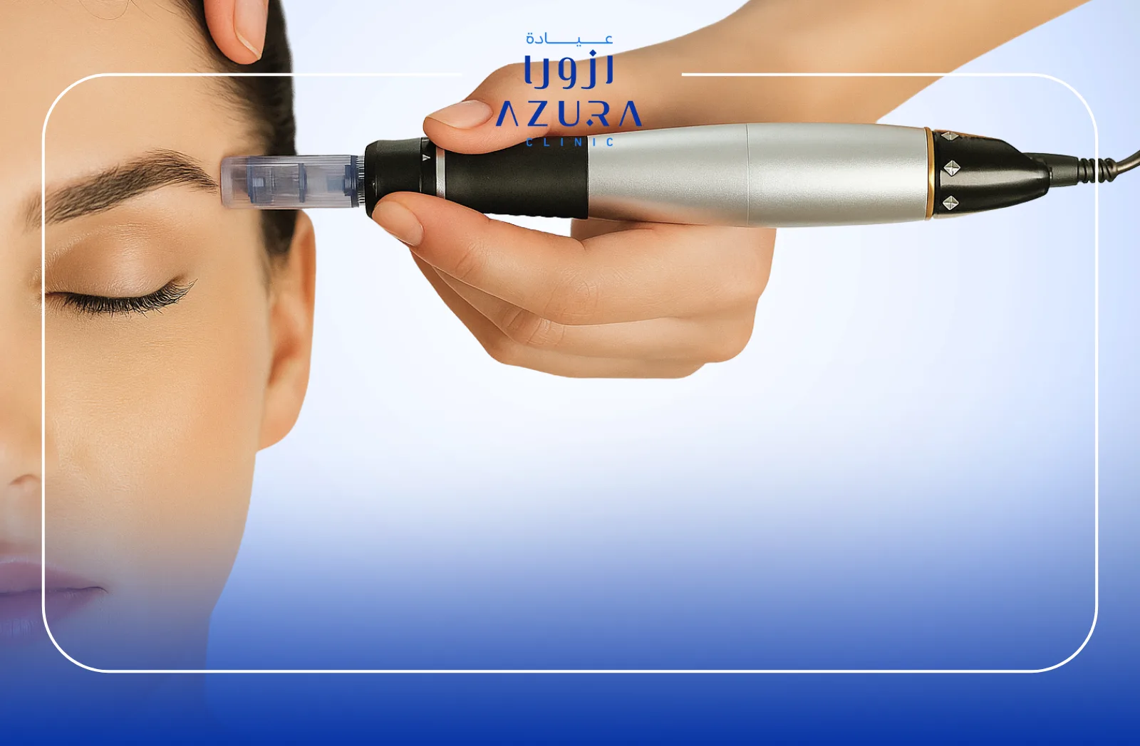Reduce Scars